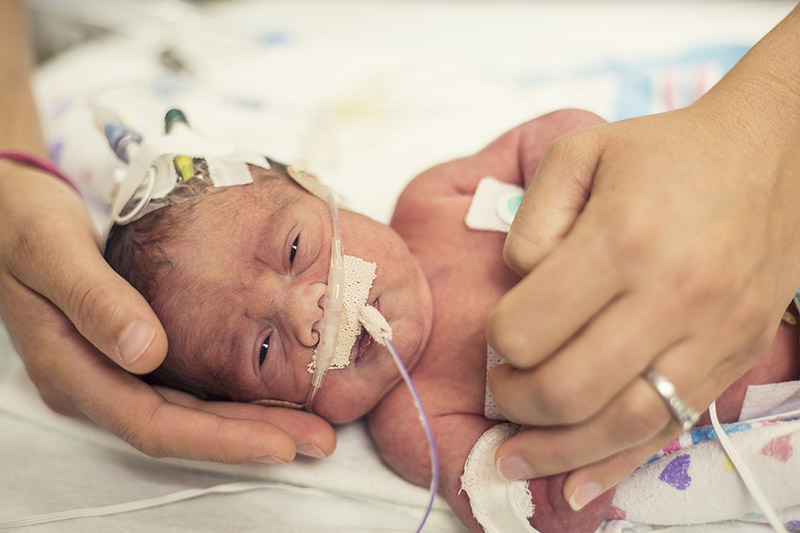 premature-newborn-baby