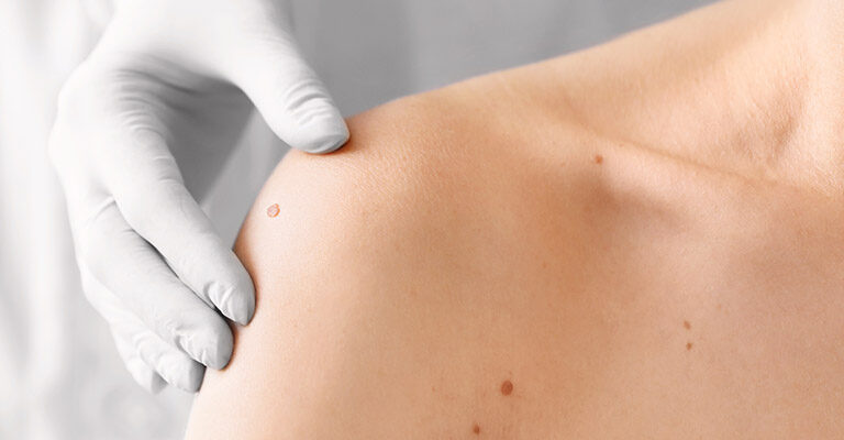 Procedures
